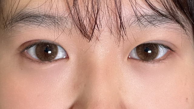 手术前的状态 其一