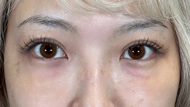 手术前的状态 其一