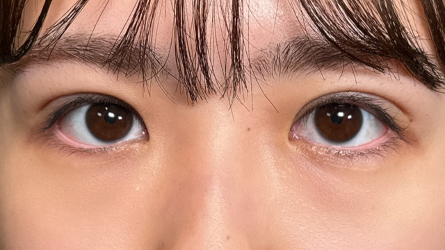 手术前的状态 其一