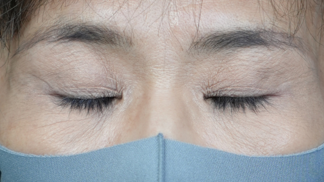 手术前的状态 其一