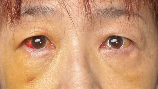 手术前的状态 其一