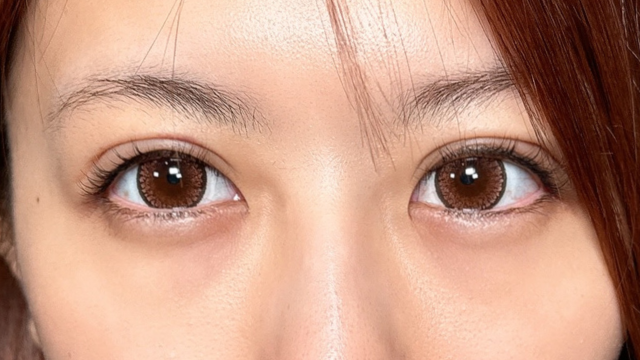 手术前的状态 其一