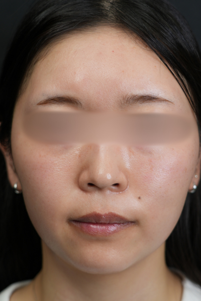 Postoperative Condition Part 1