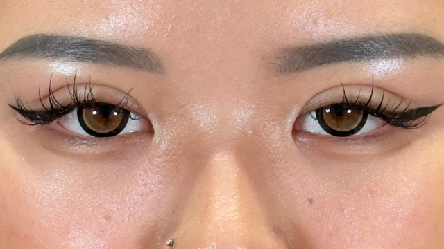 手術前の状態 その1