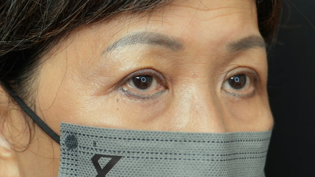 手术前的状态 其一