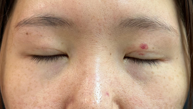 Postoperative Condition Part 1