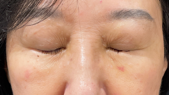 手术前的状态 其一