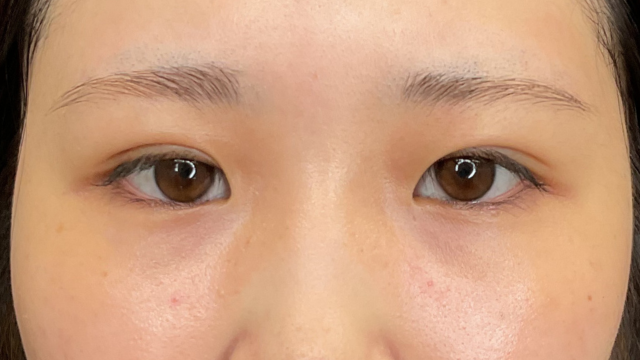 手术前的状态 其一