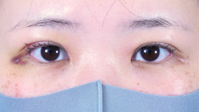 Postoperative Condition Part 1