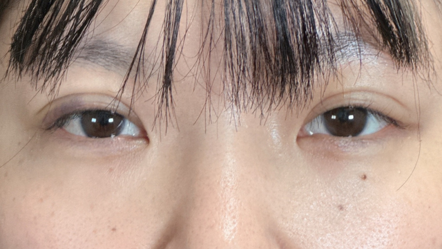 手术前的状态 其一