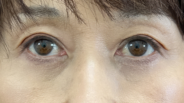 手术前的状态 其一