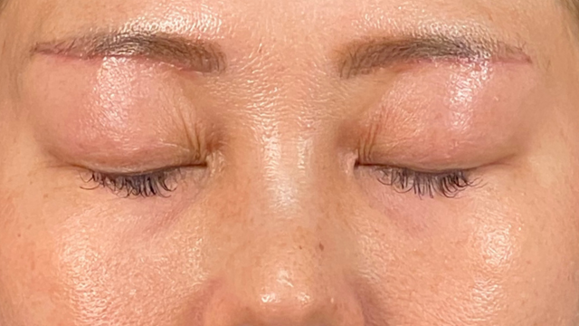 Postoperative Condition Part 1