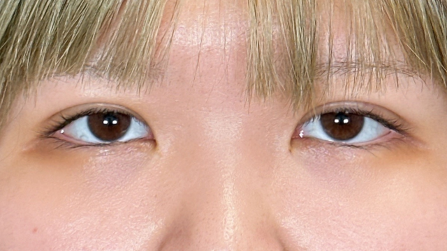 手术前的状态 其一