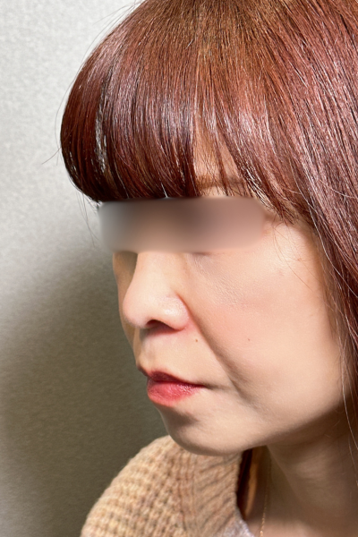 Postoperative Condition Part 1