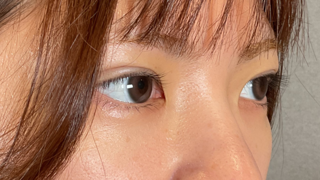 手术前的状态 其一