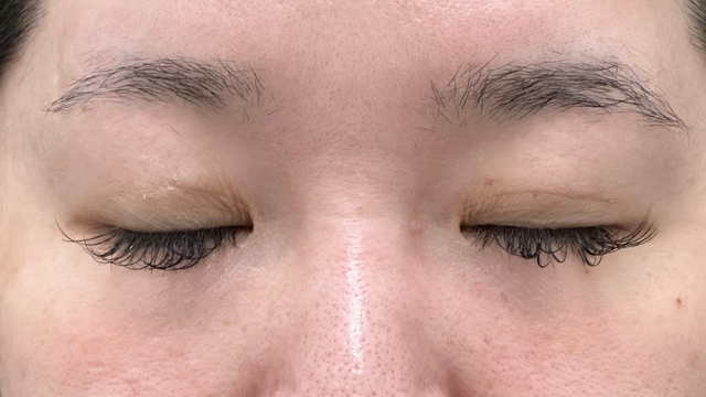 Postoperative Condition Part 1