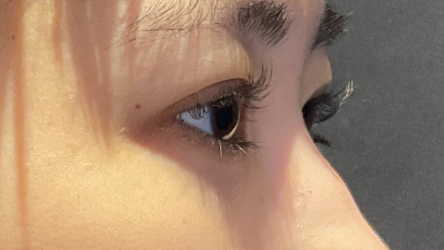 手术前的状态 其一