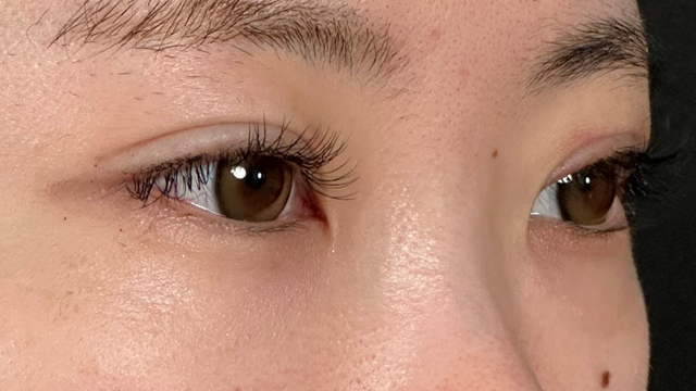 Postoperative Condition Part 1