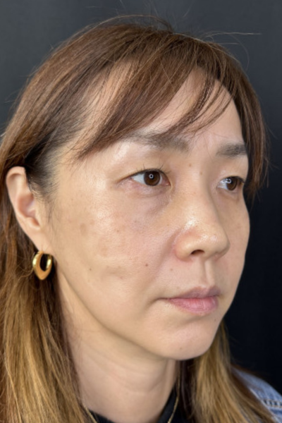 手术前的状态 其一