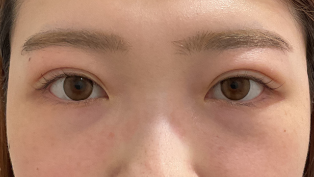 Postoperative Condition Part 1