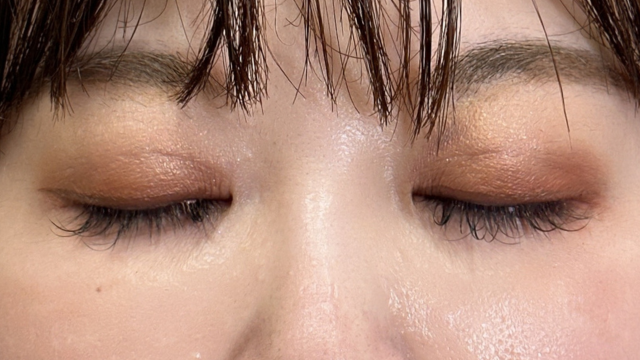 手术前的状态 其一