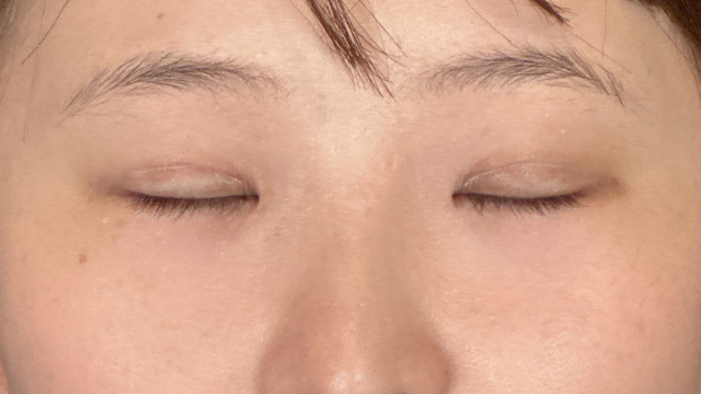 Postoperative Condition Part 1