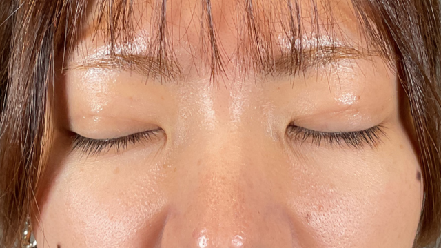 手术前的状态 其一