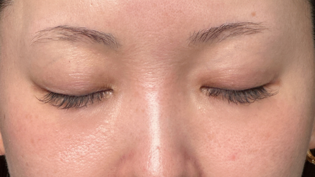 Postoperative Condition Part 1