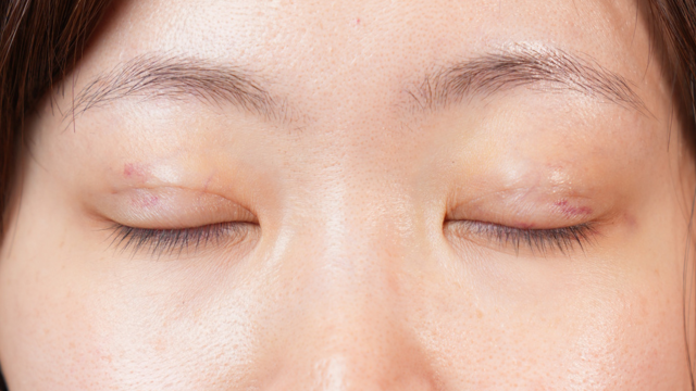 手術前の状態 その1