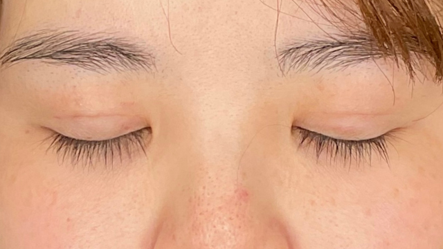 手术前的状态 其一