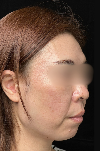 手術前の状態 その1