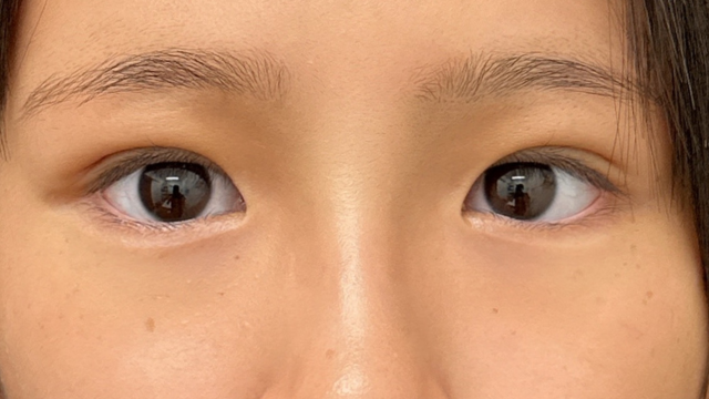 手术前的状态 其一