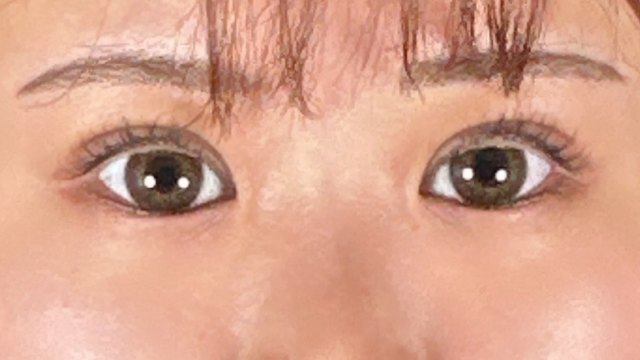 手术前的状态 其一