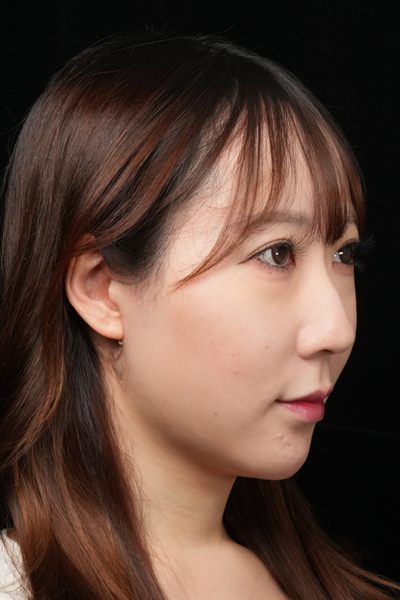 手术前的状态 其一