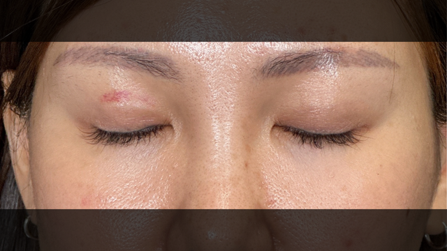 Postoperative Condition Part 1