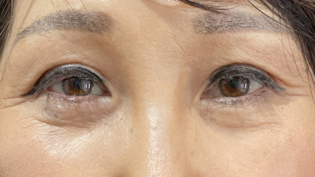 手术前的状态 其一