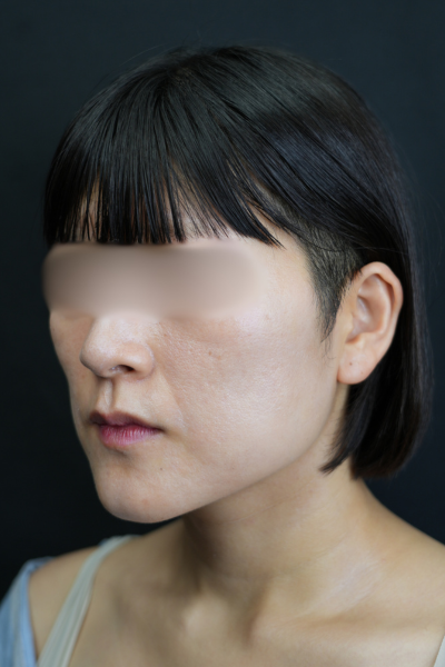 手术前的状态 其一