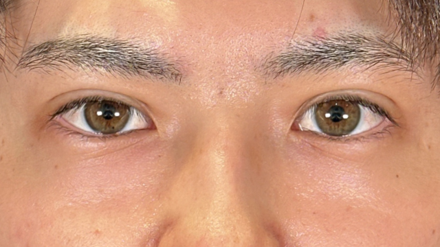 Postoperative Condition Part 1