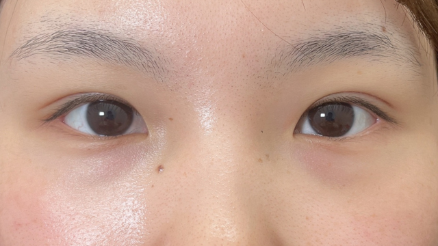 Postoperative Condition Part 1