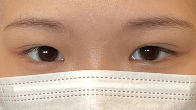 Postoperative Condition Part 1