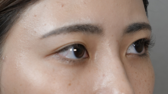 Postoperative Condition Part 1