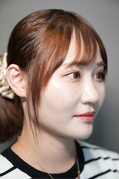 手术前的状态 其一