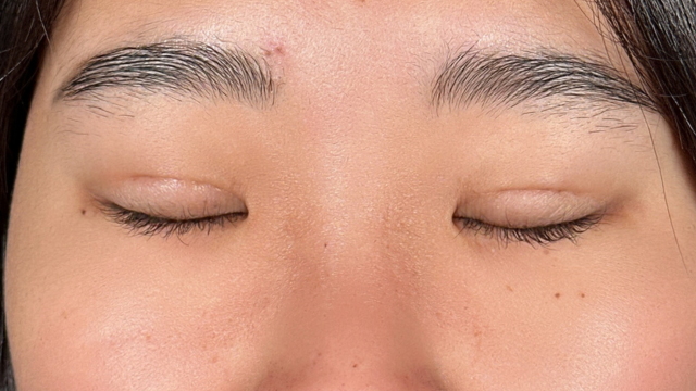 手术前的状态 其一