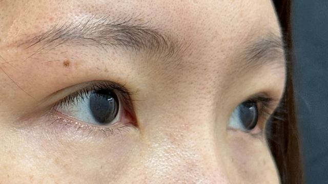 Postoperative Condition Part 1