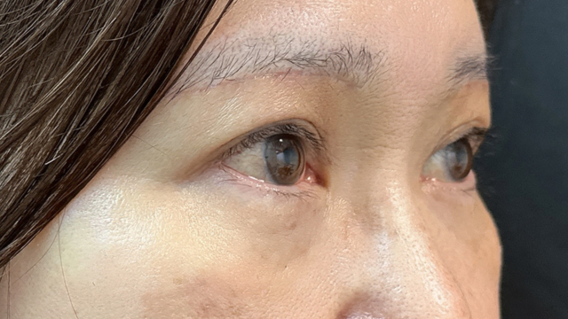 Postoperative Condition Part 1