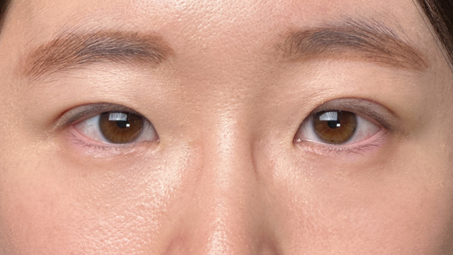 Postoperative Condition Part 1