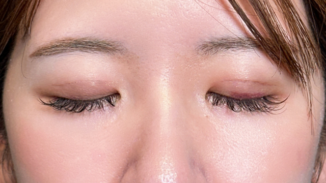 手术前的状态 其一