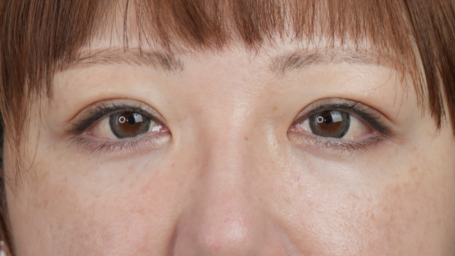 手术前的状态 其一