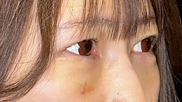 手术前的状态 其一