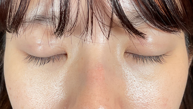 手术前的状态 其一